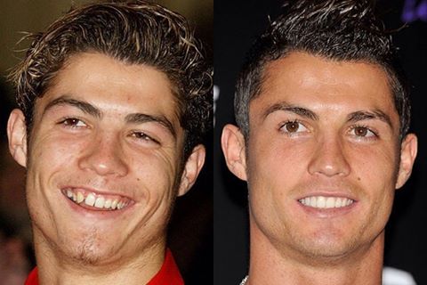 Cristiano Ronaldo B&A